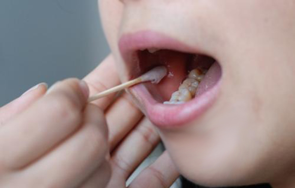 郑州如何私下做血缘检测,郑州亲子鉴定办理的流程