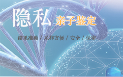 郑州医院亲子鉴定如何办理专家咨询，郑州医院办理亲子鉴定费用是多少钱