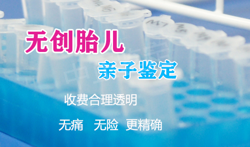 郑州胎儿亲子鉴定大概收费,